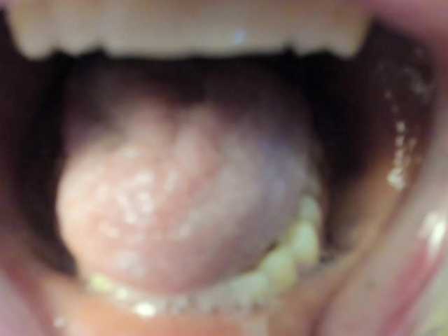 Captures d'écran de diffusion spellmananto